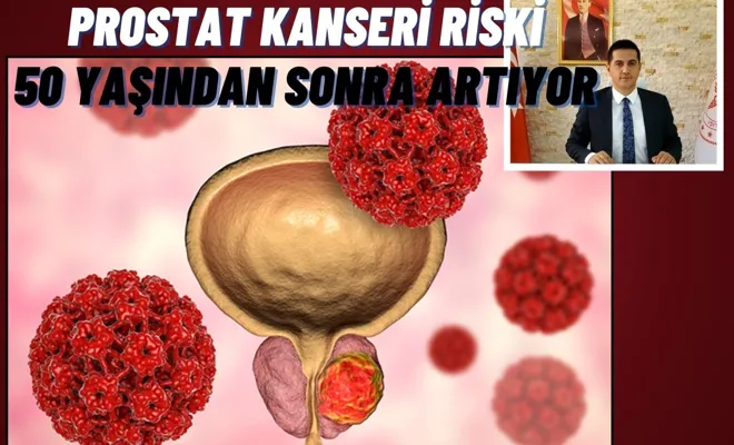 Prostat Kanseri Riski 50 yaşından sonra artıyor