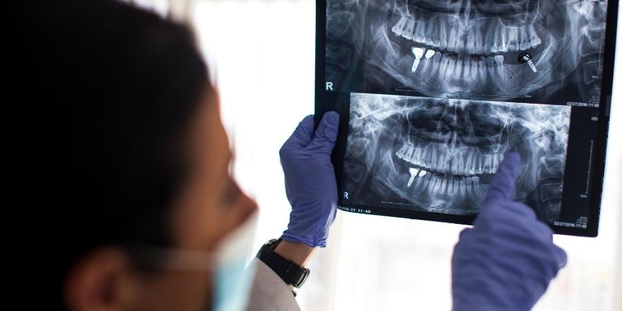 Kanal tedavisi ve dolgu yapılan diş neden ağrır?